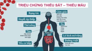 thiếu máu do thiếu sắt ở người lớn