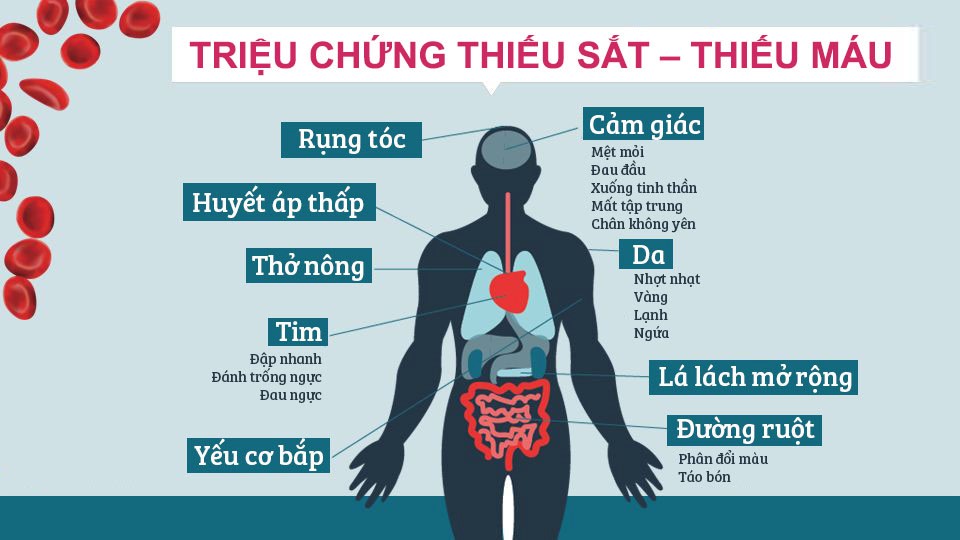 thiếu máu do thiếu sắt ở người lớn