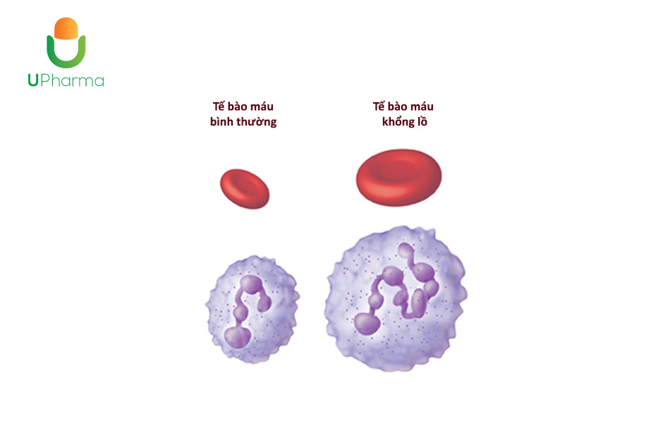thiếu máu do thiếu vitamin B12 - Image 3