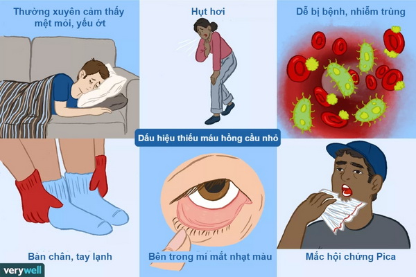 thiếu máu là gì - Image 2