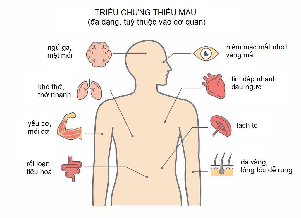 thiếu máu là gì - Image 3