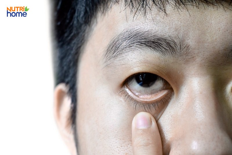 thiếu sắt ở người trưởng thành - Image 3