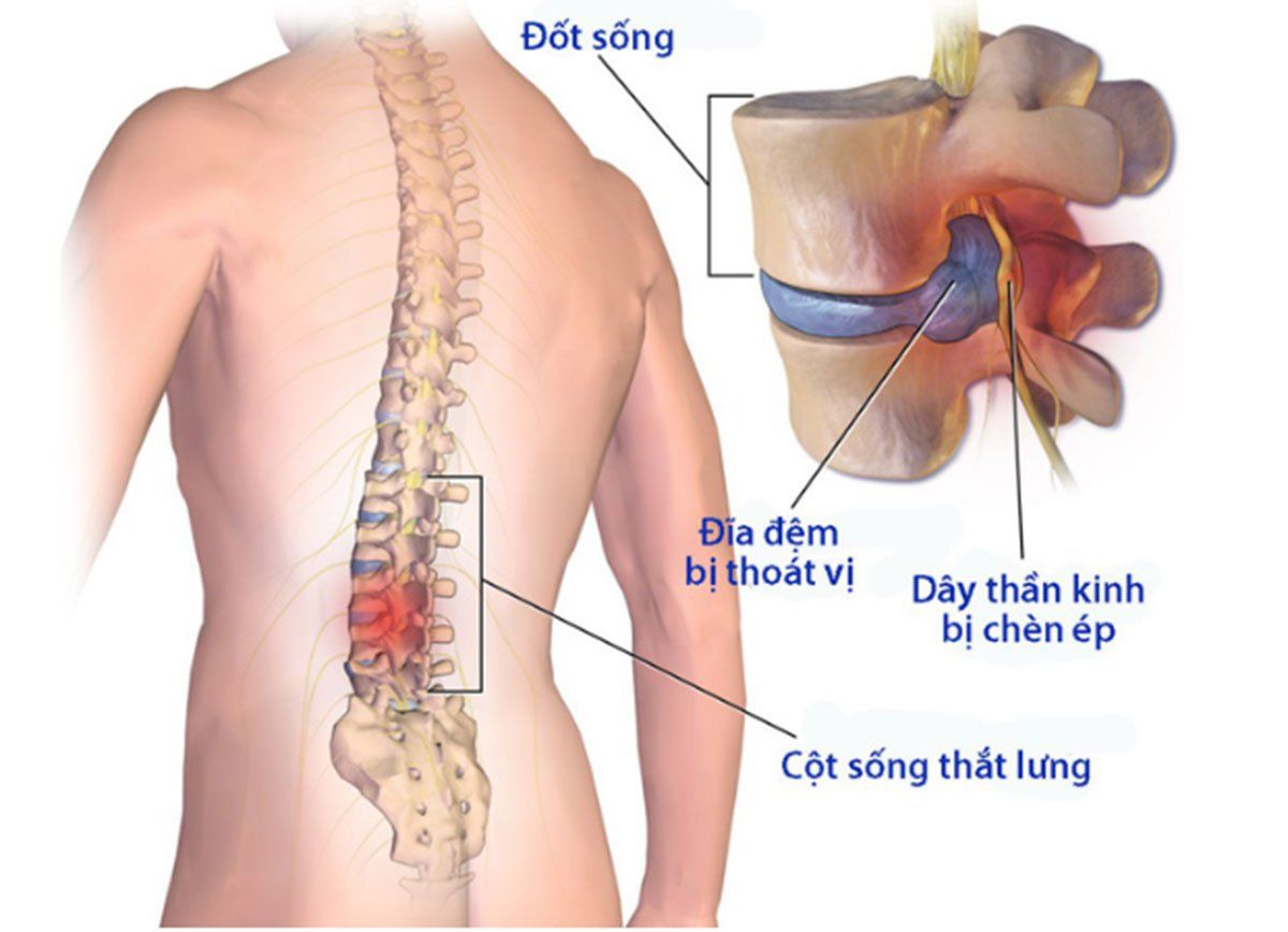thoai hoa cot song english - Image 3
