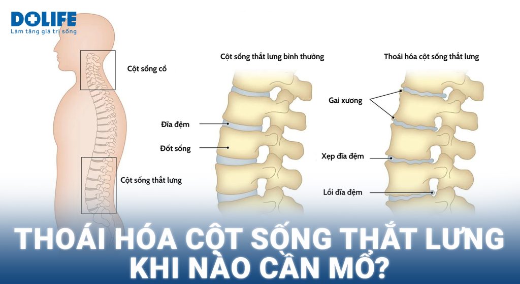 thoai hoa cot song english - Image 5