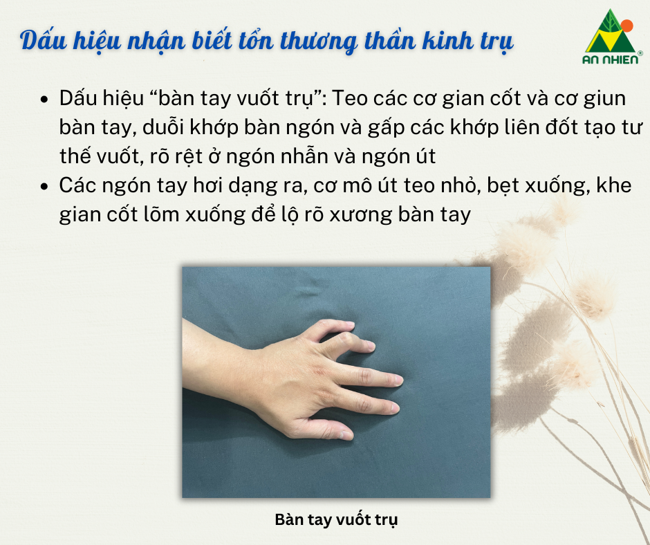 thời gian hồi phục dây thần kinh trụ - Image 2