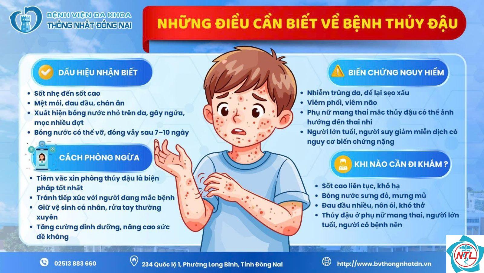 thủy đậu ở người suy giảm miễn dịch - Image 5