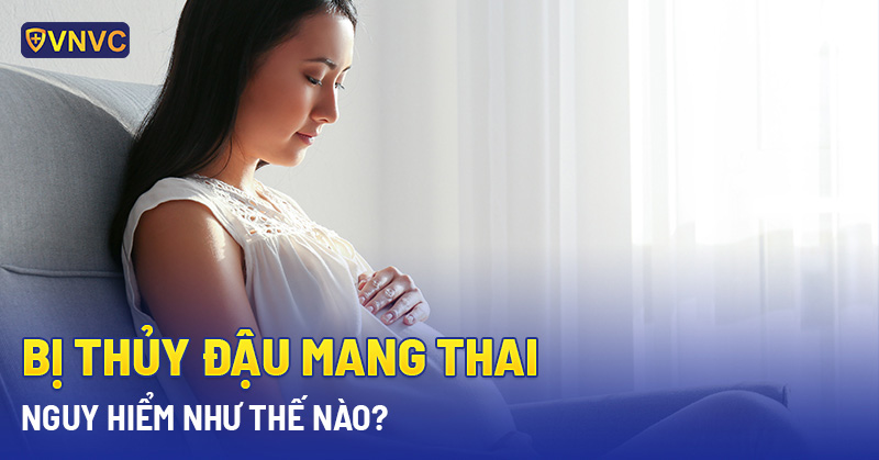 thủy đậu ở phụ nữ mang thai