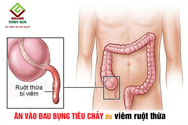 tiêu chảy kèm đau bụng - Image 5