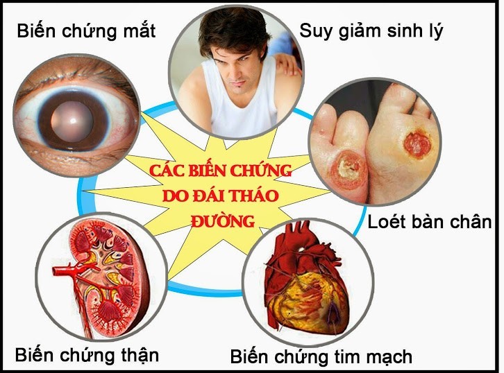 tiểu đường type 1 - Image 3