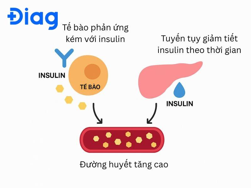 tiểu đường type 2 - Image 3