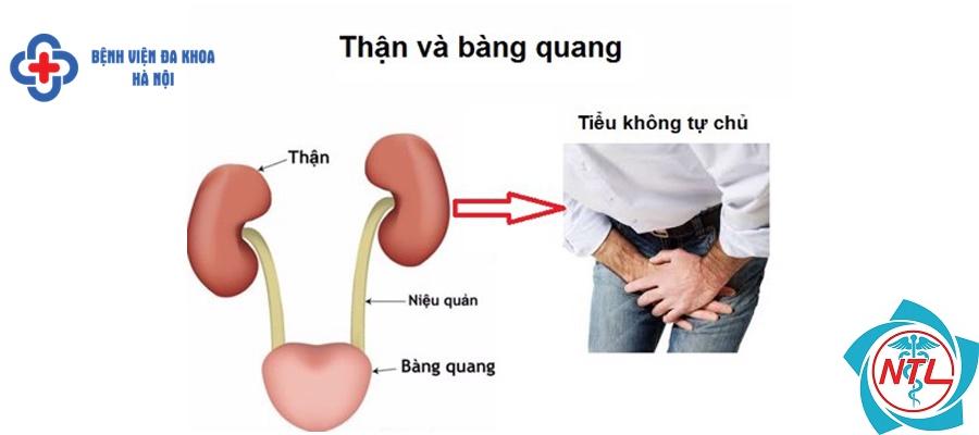 tiểu không tự chủ - Image 2