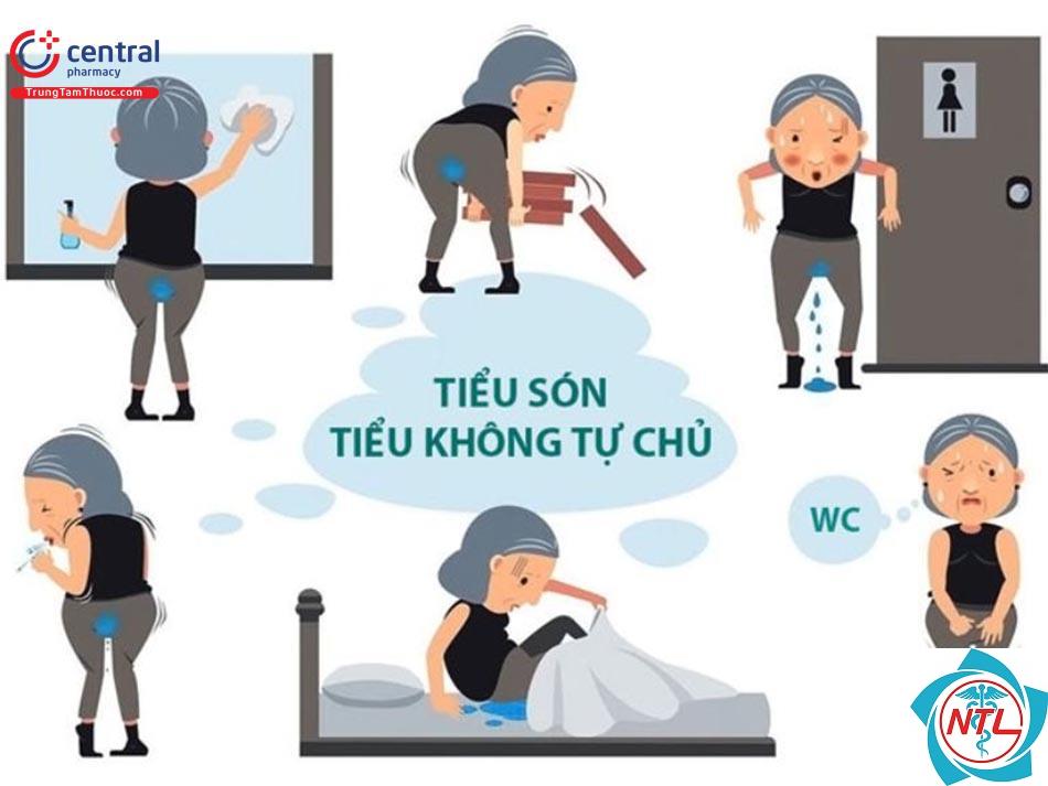 tiểu không tự chủ do gắng sức