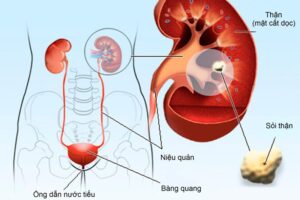 tiểu nhiều lần là dấu hiệu gì