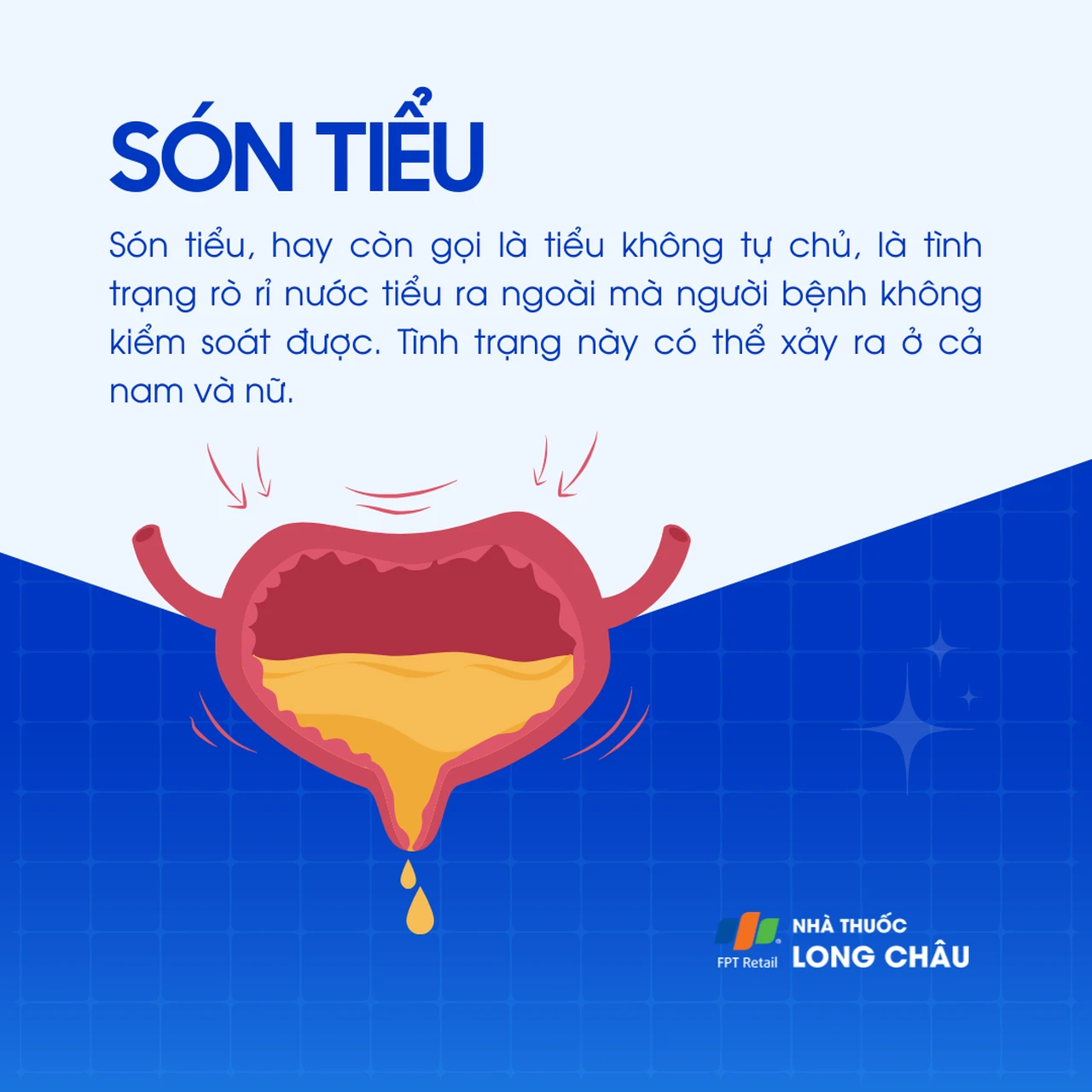 tiểu són - Image 2