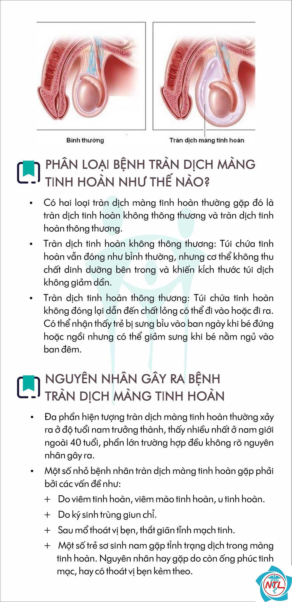 tràn dịch màng tinh hoàn - Image 5