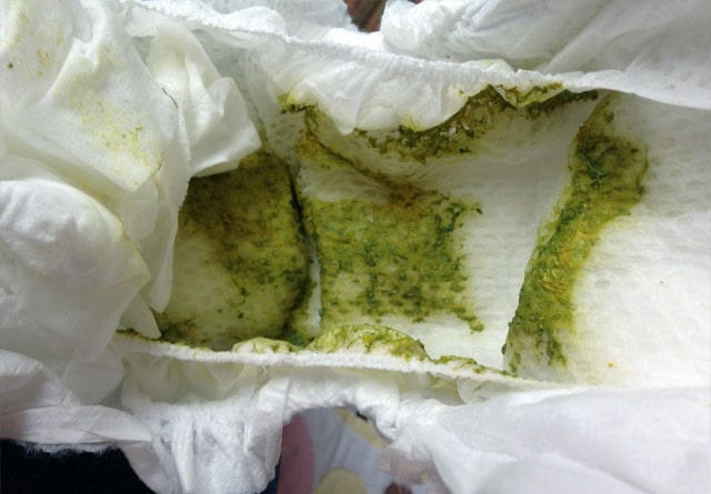 trẻ 7 tháng ngày đi ngoài 3 lần - Image 5