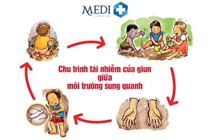 trẻ em uống thuốc tẩy giun khi nào - Image 4