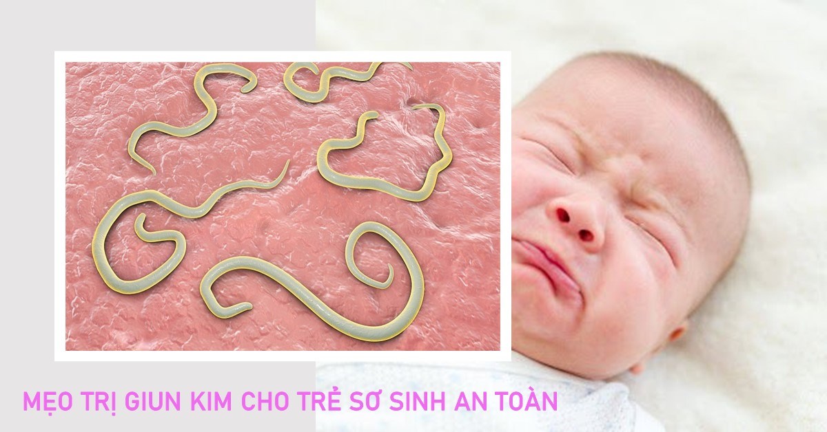 trẻ sơ sinh có bị giun không - Image 1