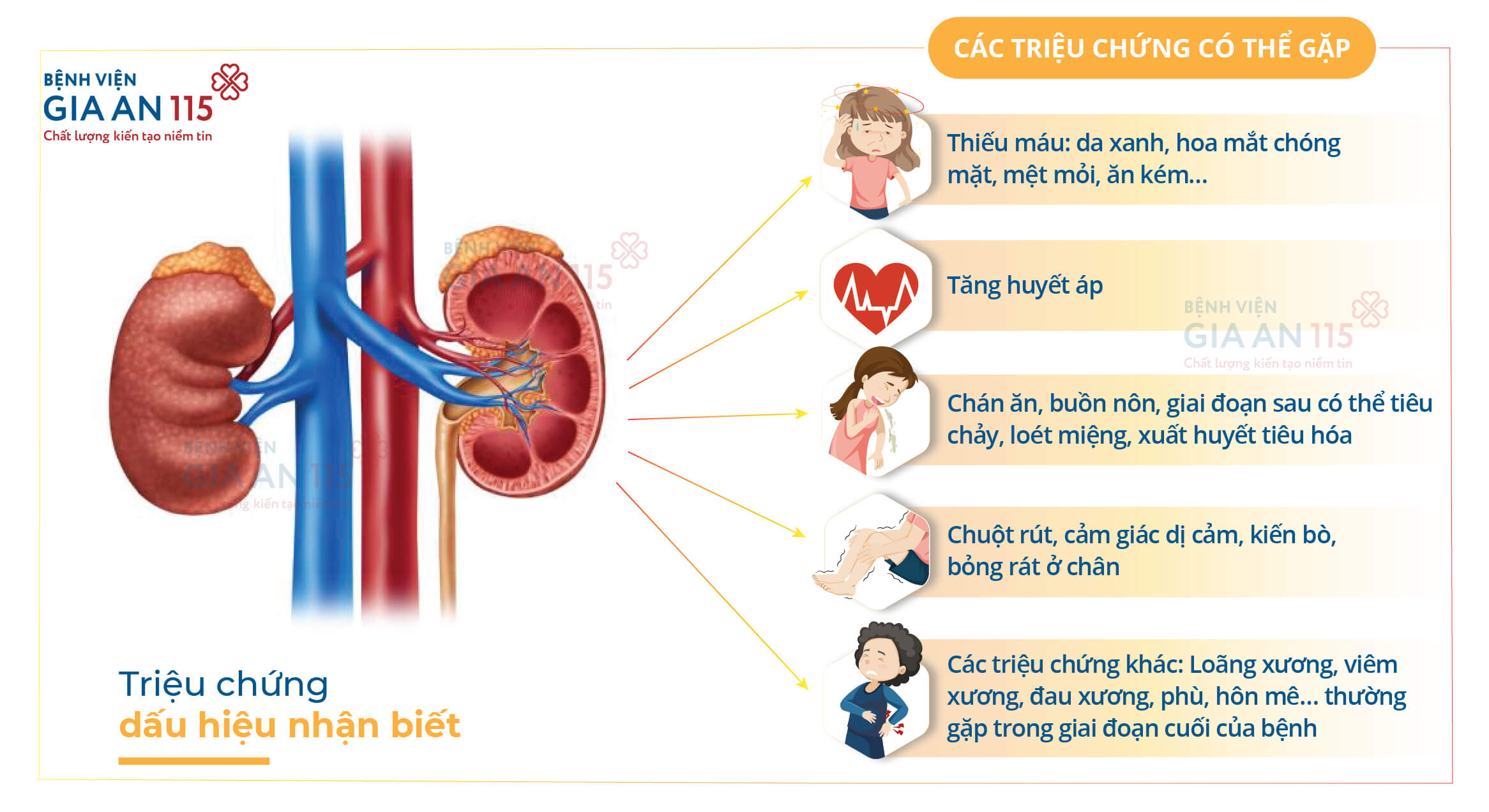 triệu chứng bệnh thận mạn - Image 4
