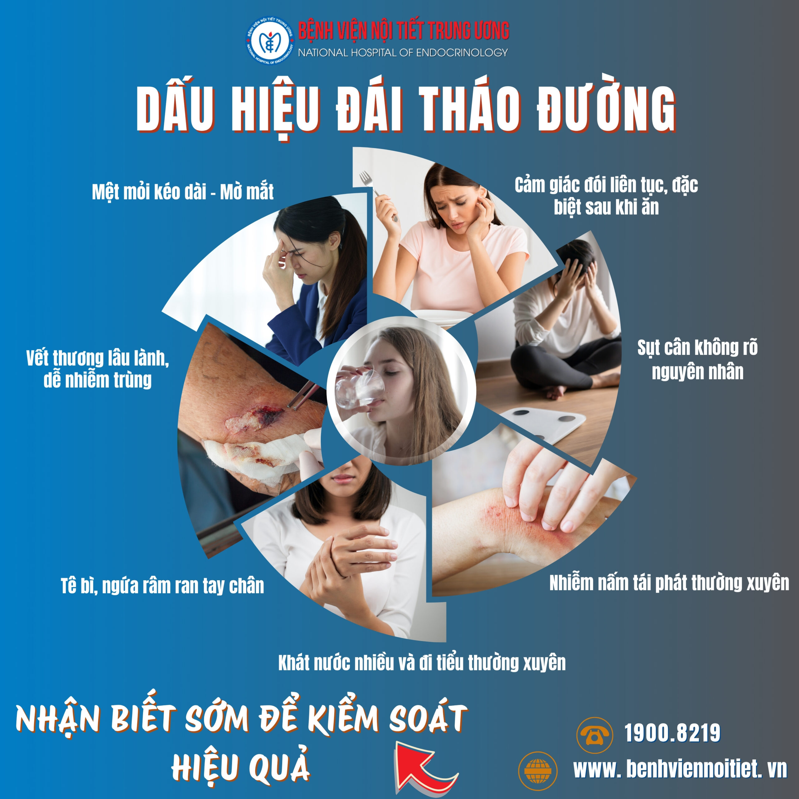 triệu chứng đái tháo đường - Image 2