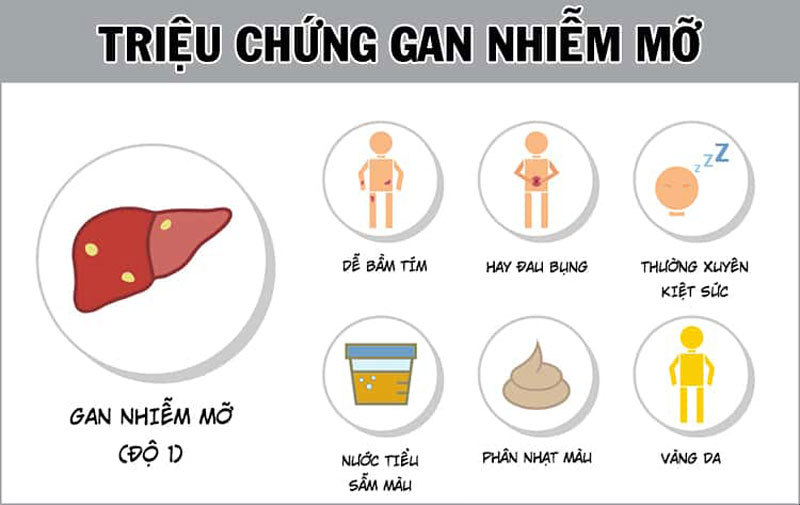 triệu chứng gan nhiễm mỡ - Image 2