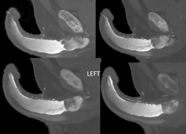 trieu chung gay duong vat - Image 5
