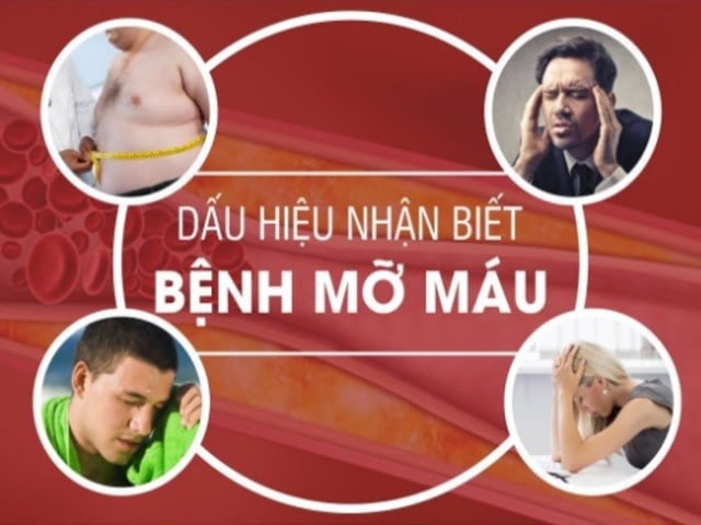 triệu chứng mỡ máu cao - Image 3