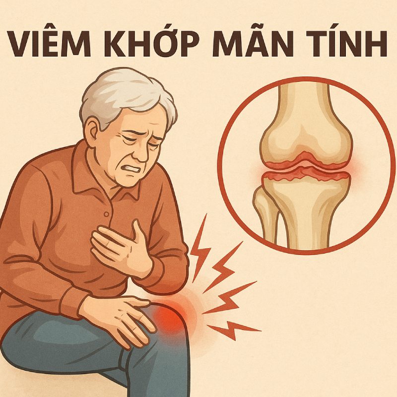 triệu chứng mục xương - Image 2