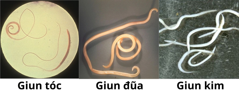 triệu chứng sau khi uống thuốc xổ giun - Image 1