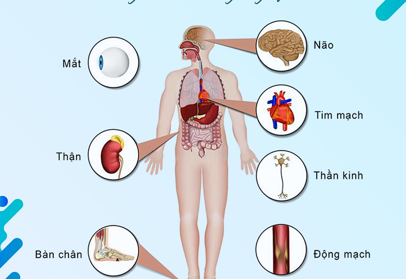 triệu chứng tăng đường huyết - Image 2