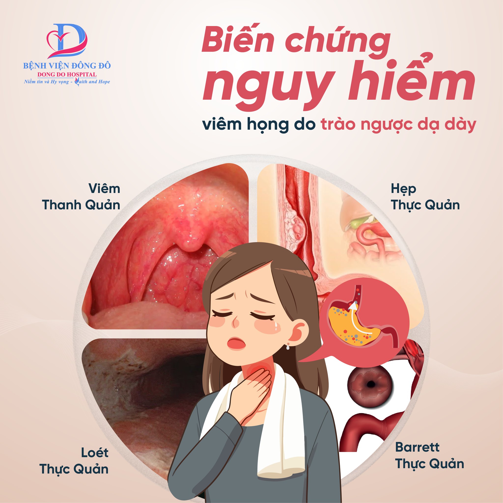 triệu chứng trào ngược dạ dày - Image 2