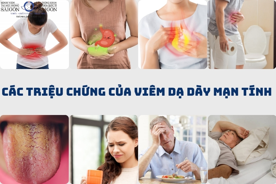 triệu chứng viêm dạ dày - Image 5