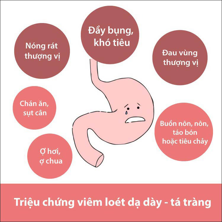 triệu chứng viêm loét dạ dày