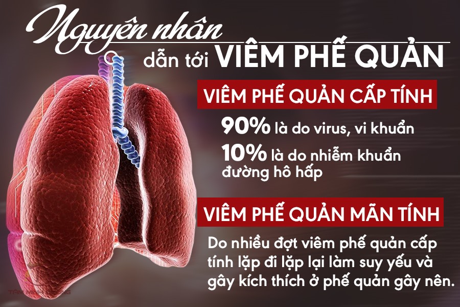 triệu chứng viêm phế quản - Image 5