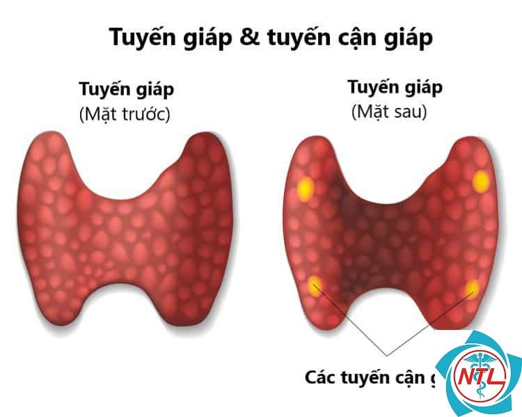 tuyến giáp trạng - Image 5