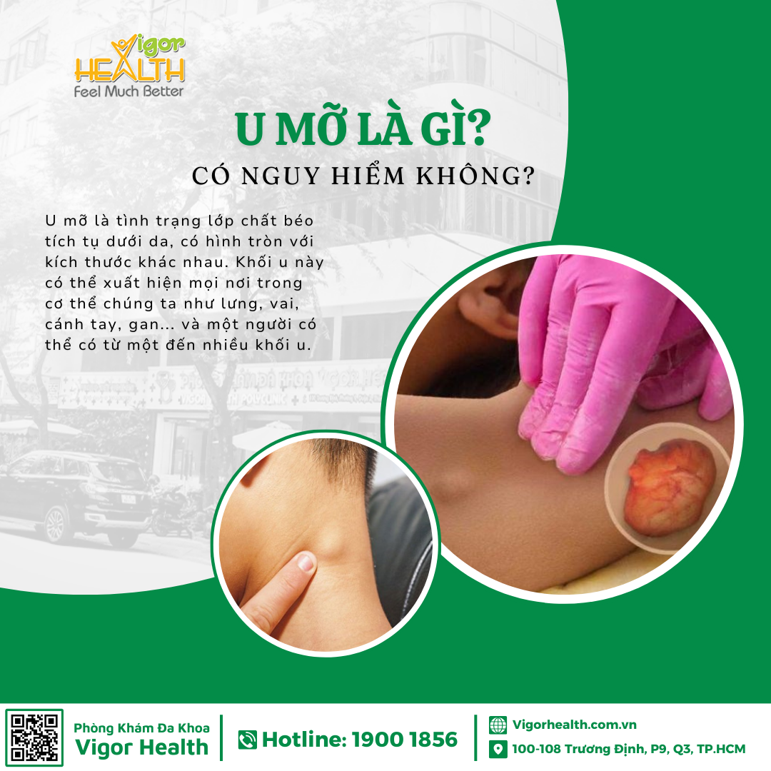 u mỡ dưới da - Image 3