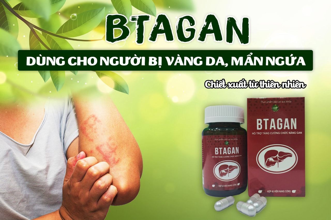 vàng da kèm ngứa - Image 3
