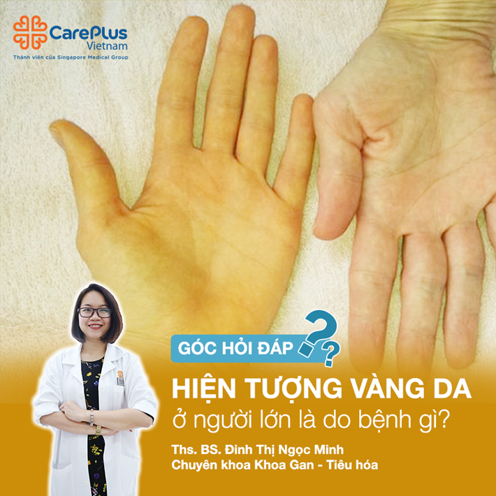 vàng da ở người lớn - Image 5
