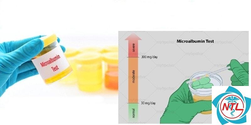 vi đạm niệu