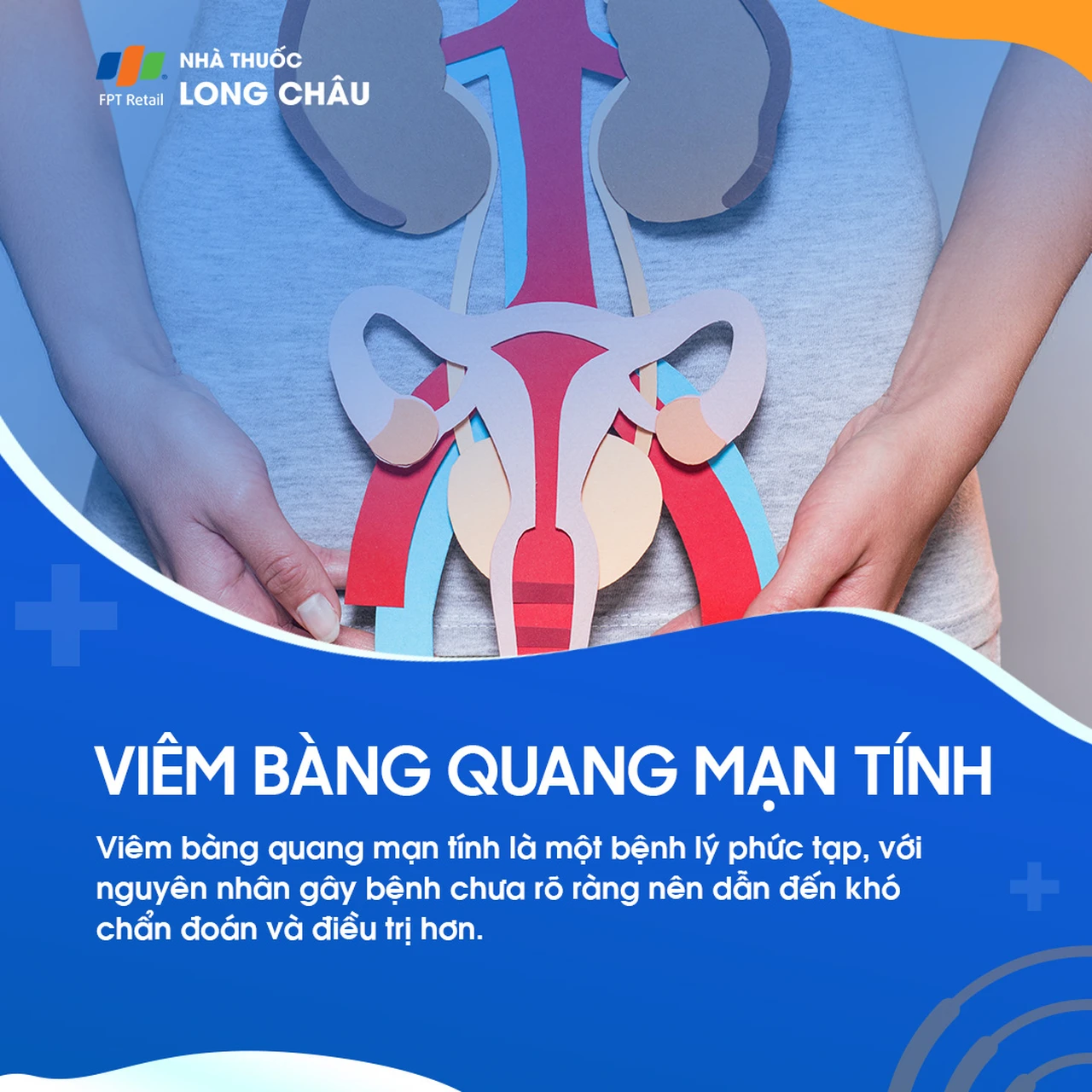 viêm bàng quang mạn - Image 5