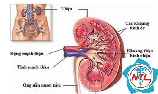 viêm bể thận - Image 3