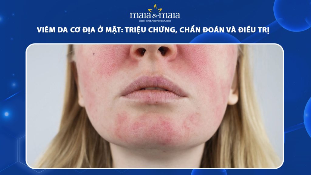viêm da cơ địa ở mặt - Image 3