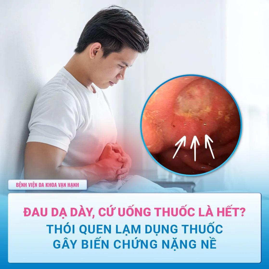 viêm dạ dày do thuốc - Image 5