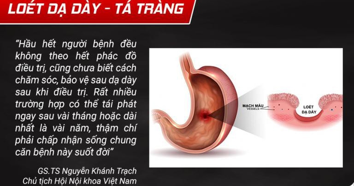 viêm dạ dày tái phát - Image 3