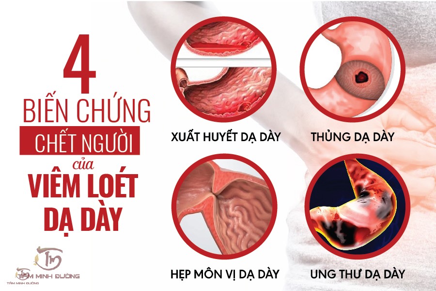 viêm dạ dày