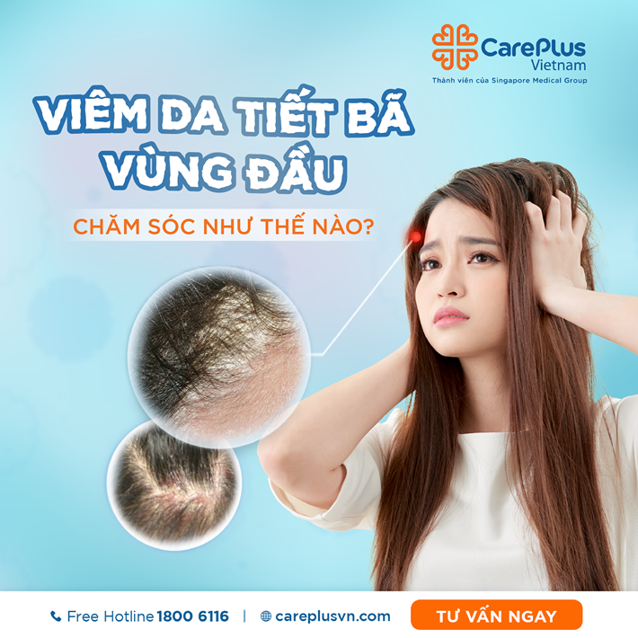 viêm da tiết bã da đầu - Image 5