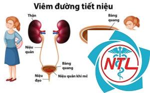 viêm đường tiết niệu