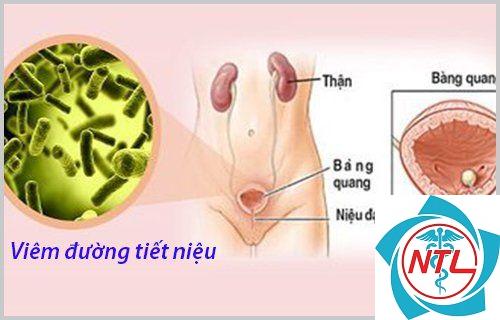 viêm đường tiểu - Image 4