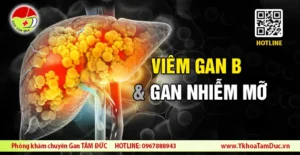 viêm gan B và gan nhiễm mỡ
