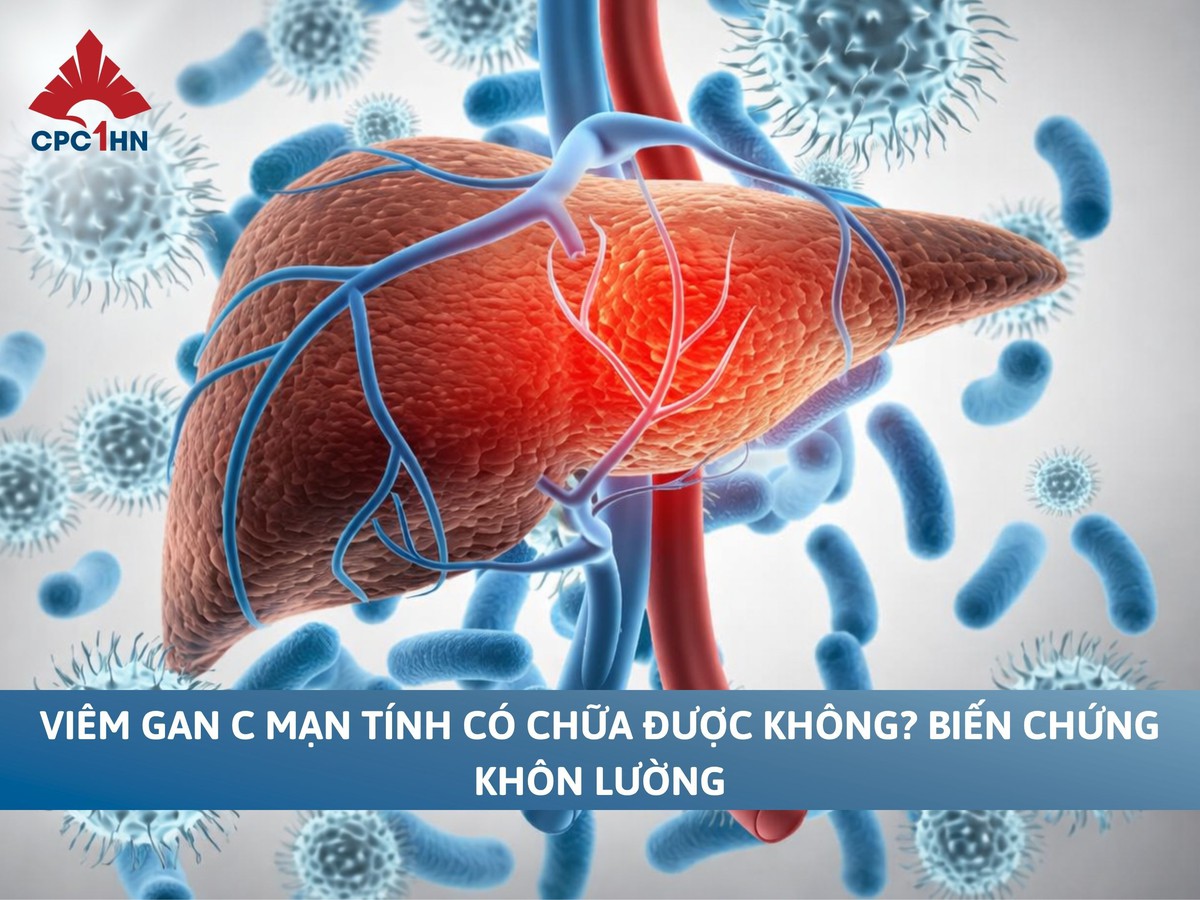 viêm gan C mạn tính - Image 4
